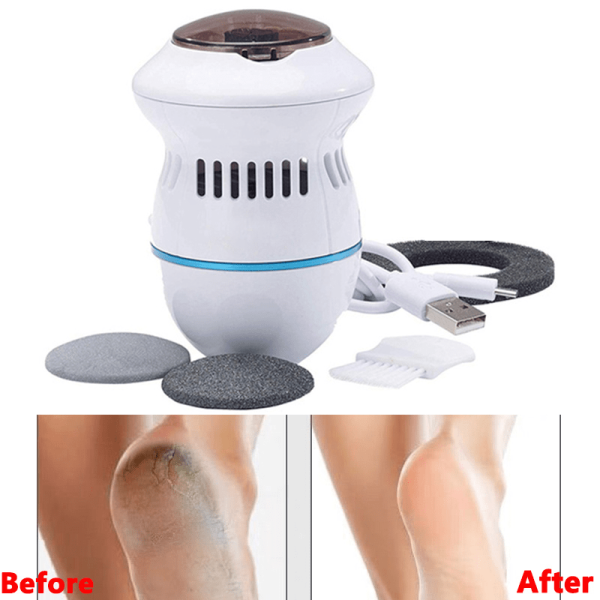 Pedi Vac Remover Rechargeable