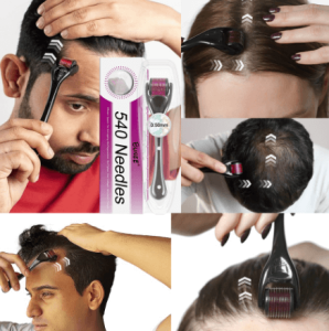 7 Days Hair Growth serum with Derma Roller