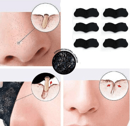 Buy the Best Quality 10 PCS Nose Black head Remover Mask Skin Care in Pakistan at DayShop.pk. Most Affordable Price With Fast Shipping in All Over Pakistan