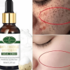 Buy the Best Quality Anti-Freckle Whitening Facial Serum in Pakistan at DayShop.pk. Most Affordable Price With Fast Shipping in All Over Pakistan
