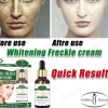 Buy the Best Quality Anti-Freckle Whitening Facial Serum in Pakistan at DayShop.pk. Most Affordable Price With Fast Shipping in All Over Pakistan