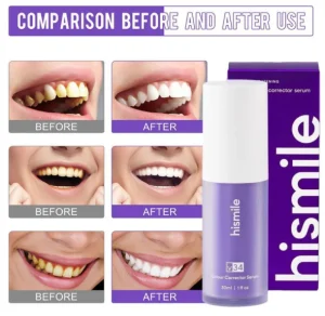 Buy the Best Quality Hismile V34 Colour Instant Teeth Whitening in Pakistan at DayShop.pk. Most Affordable Price With Fast Shipping in All Over Pakistan